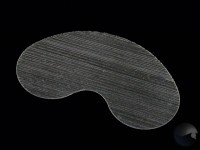 Martin Cut fibroid burned Martin Cut fibroid burned